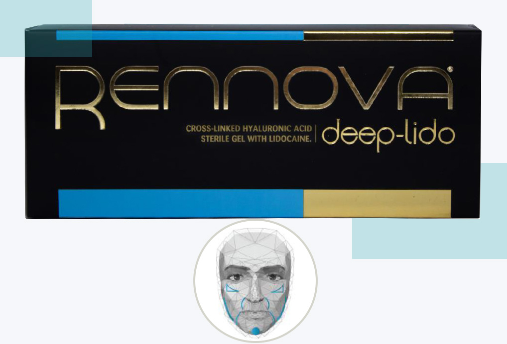 Rennova Deep-Lido